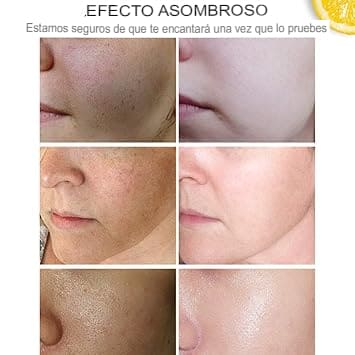 Serum Rejuvenecedor con Vitamina C + Acido hialurónico